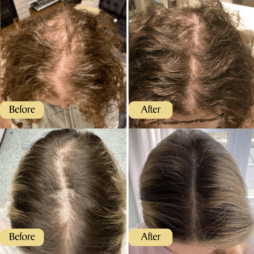 Carvenchy Natural Hair Growth Oil - ShopLorca