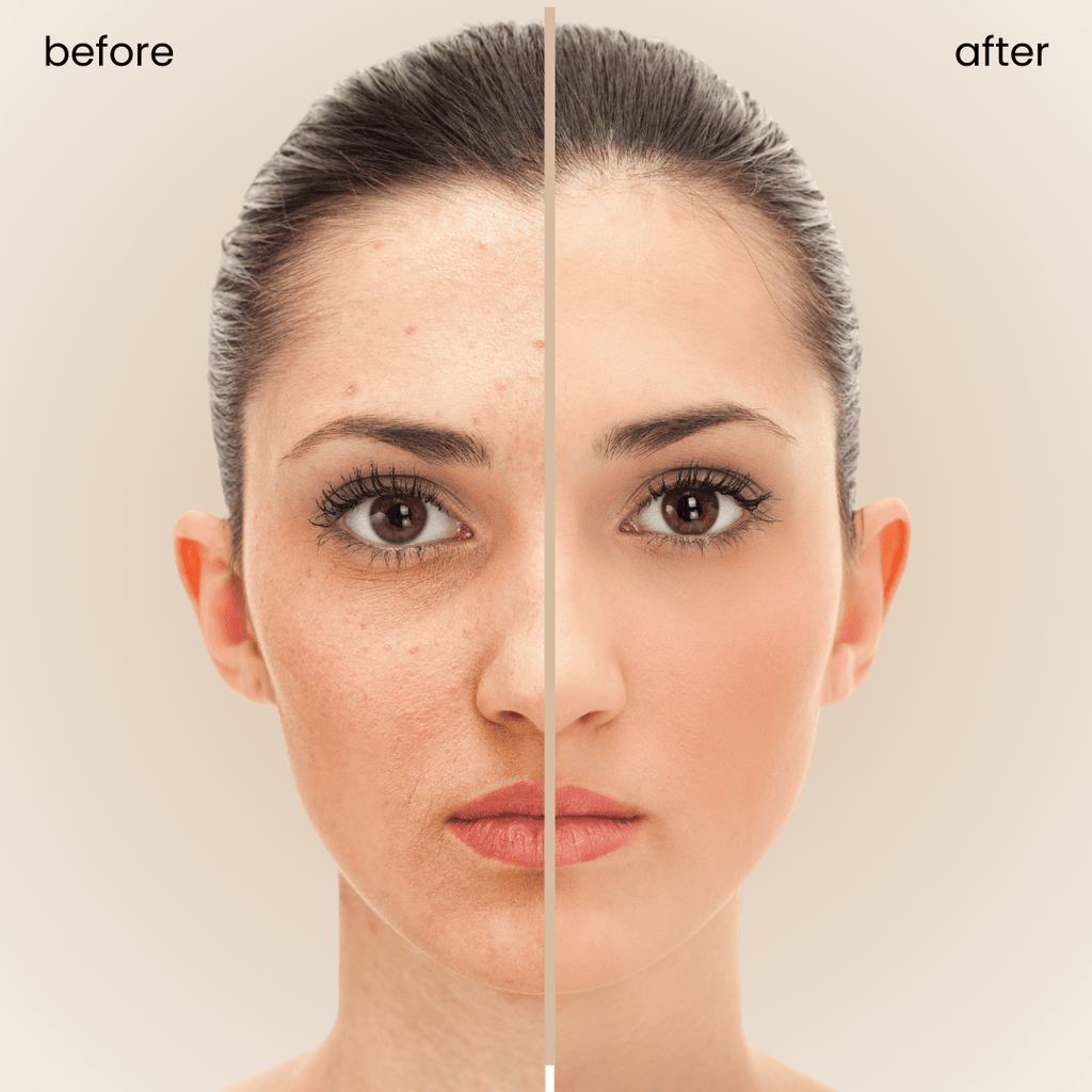 Splendor Serum Boosted Skin Tint Balm - ShopLorca